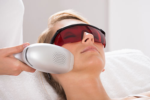IPL-laser-treatment-on-face