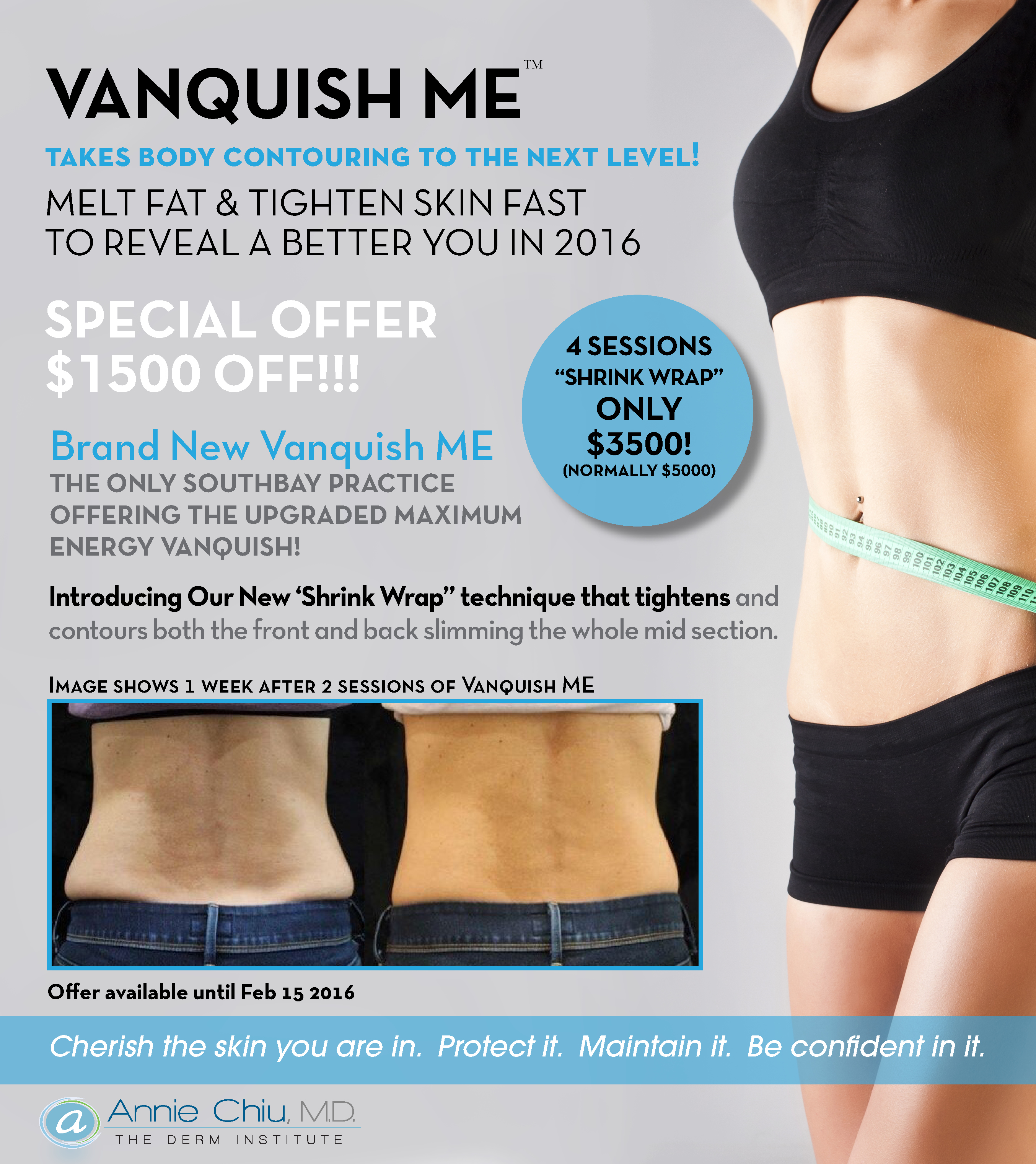 Say Hello to CoolSculpting and Goodbye to That Muffin Top: Manuel