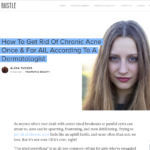 Bustle.com January 2016 “How to Get Rid of Chronic Acne Once & For All, According to a Dermatologist”