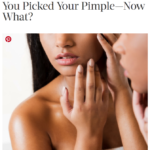 InStyle.com August 2016 “You Picked Your Pimple—­Now What?”