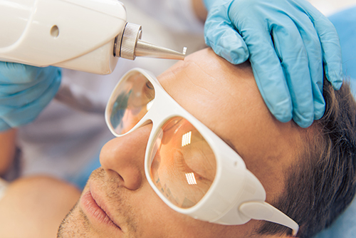 man receiving sun spot treatment