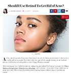 Stylecaster.com May 2017 “Should I Use Retinol To Get Rid of Acne?”
